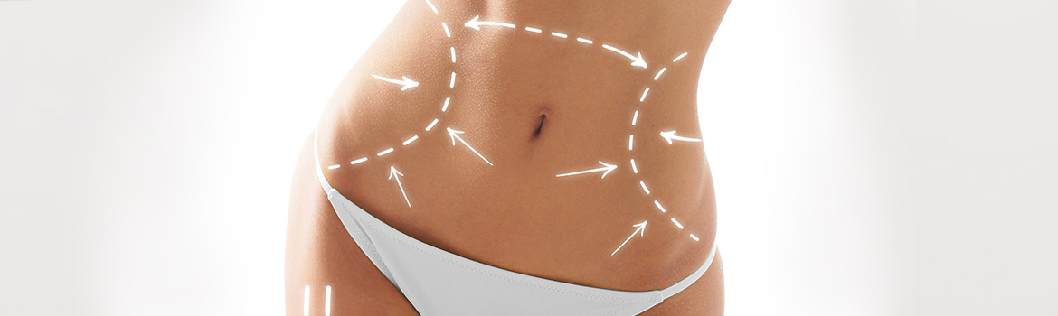 Abdominoplastie (ventre) Abdominoplastie (ventre)