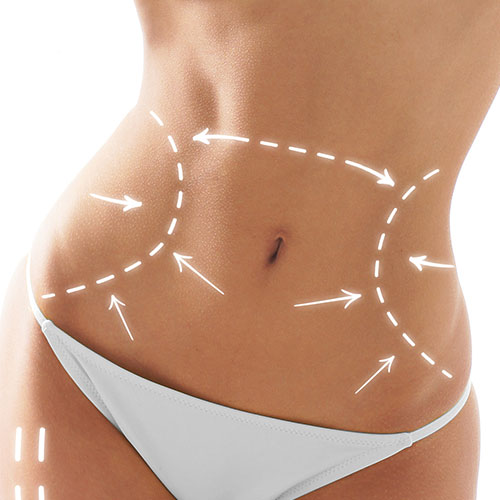 Chirurgie abdominoplastie bordeaux