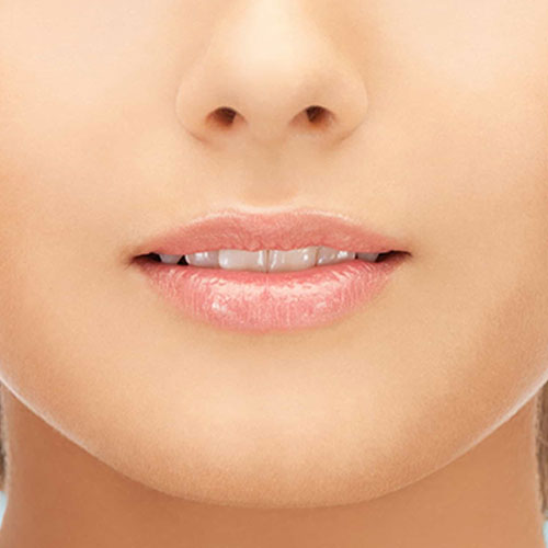 Dermabrasion-des-levres-femme