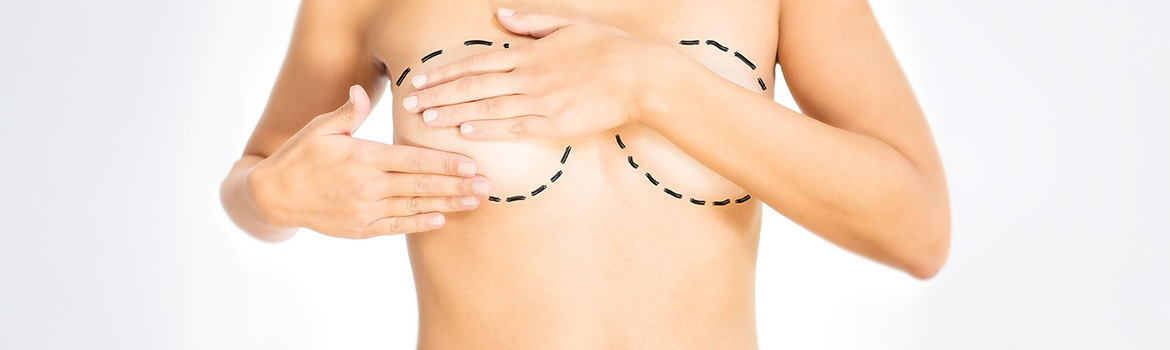 Lipomodelage des seins Lipomodelage des seins