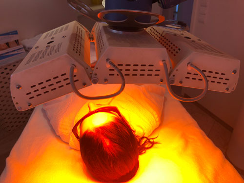 Luminothérapie cheveux bordeaux