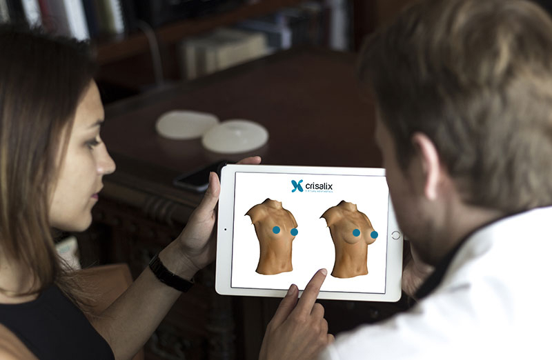 Prenez RDV pour une consultation 3D Crisalix